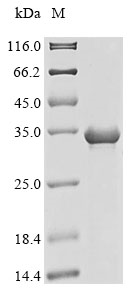 Recombinant Human Trypsin-1(PRSS1)