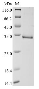 Recombinant Human Tryptase beta-2(TPSB2)