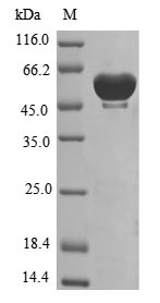 Recombinant Human Tryptophan--tRNA ligase, cytoplasmic(WARS)