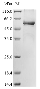 Recombinant Human Tryptophan 5-hydroxylase 2(TPH2)