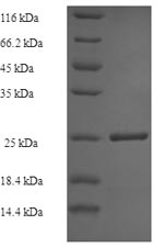 Recombinant Human Tubulinyl-Tyr carboxypeptidase 1(VASH1)