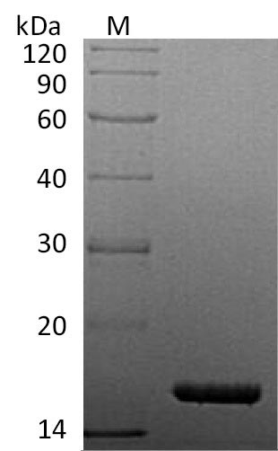 Recombinant Human Tumor necrosis factor(TNF),partial (Active)