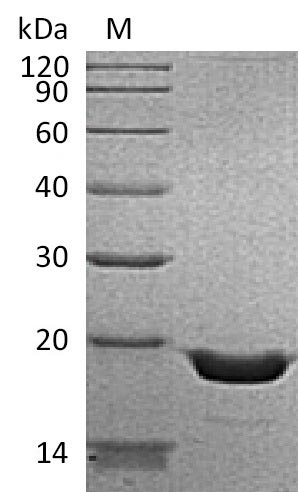Recombinant Human Tumor necrosis factor(TNF),partial (Active)