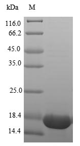 Recombinant Human Tumor necrosis factor(TNF),partial (Active)