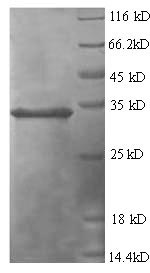 Recombinant Human Tumor necrosis factor-inducible gene 6 protein(TNFAIP6)