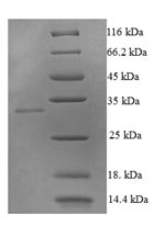 Recombinant Human Tumor necrosis factor ligand superfamily member 10(TNFSF10) ,partial