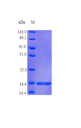 Recombinant Human Tumor necrosis factor protein(TNF),partial (Active)