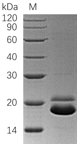 Recombinant Human Tumor necrosis factor receptor superfamily member 10B(TNFRSF10B),partial (Active)