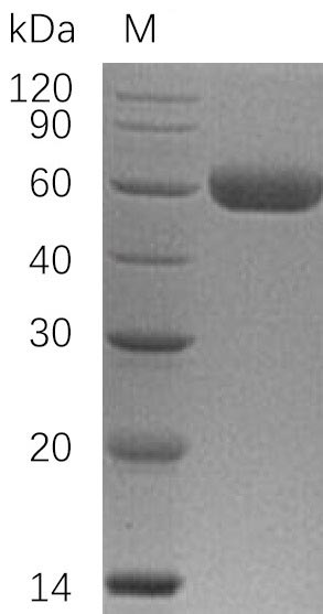 Recombinant Human Tumor necrosis factor receptor superfamily member 11B(TNFRSF11B) (Active)