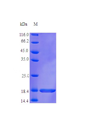 Recombinant Human Tumor necrosis factor receptor superfamily member 13B protein(TNFRSF13B) (Active)
