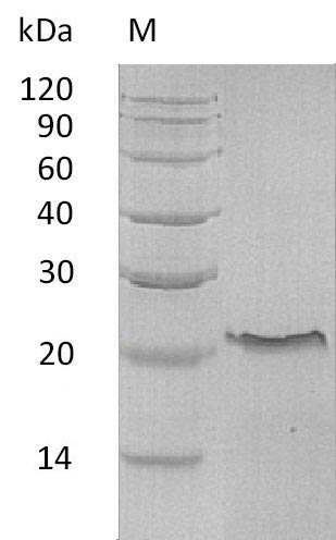 Recombinant Human Tumor necrosis factor receptor superfamily member 1A(TNFRSF1A),partial (Active)