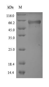 Recombinant Human Tumor necrosis factor receptor superfamily member 1A(TNFRSF1A),partial (Active)