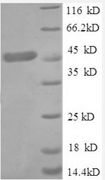 Recombinant Human Tumor necrosis factor receptor superfamily member 1A(TNFRSF1A),partial