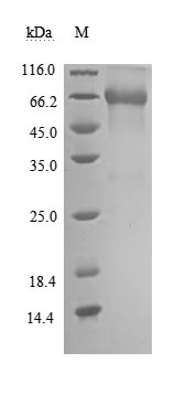 Recombinant Human Tumor necrosis factor receptor superfamily member 1B(TNFRSF1B),partial (Active)