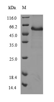 Recombinant Human Tumor necrosis factor receptor superfamily member 5(CD40),partial (Active)