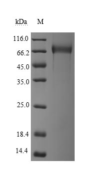 Recombinant Human Tumor necrosis factor receptor superfamily member 8(TNFRSF8),partial (Active)