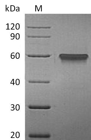 Recombinant Human Tumor necrosis factor receptor superfamily member 9(TNFRSF9),partial (Active)