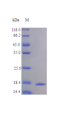 Recombinant Human Tumor necrosis factor receptor superfamily member 9 protein(TNFRSF9) (Active)
