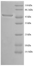 Recombinant Human Tyrosine-protein kinase ABL1(ABL1) ,partial