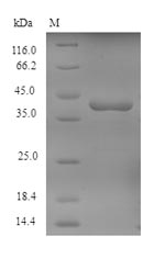 Recombinant Human Tyrosine-protein kinase JAK1(Jak1),partial