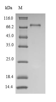 Recombinant Human Tyrosine-protein kinase Lck(LCK)