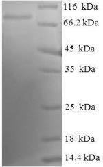 Recombinant Human Tyrosine-protein kinase Lck(LCK)