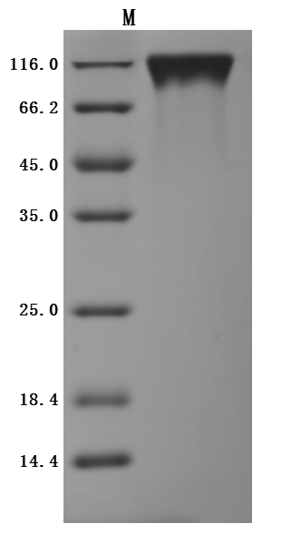 Recombinant Human Tyrosine-protein kinase Mer(MERTK),partial (Active)