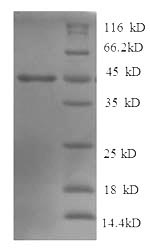 Recombinant Human Tyrosine-protein phosphatase non-receptor type 5(PTPN5),partial