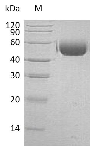 Recombinant Human Tyrosine-protein phosphatase non-receptor type substrate 1(SIRPA),partial (Active)