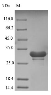 Recombinant Human U1 small nuclear ribonucleoprotein 70 kDa(SNRNP70),partial