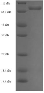 Recombinant Human UDP-glucose 6-dehydrogenase(UGDH)