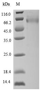 Recombinant Human UL16-binding protein 1(ULBP1) (Active)