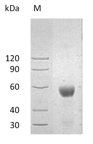 Recombinant Human UL16-binding protein 2(ULBP2),partial (Active)