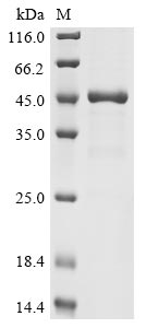 Recombinant Human UPF0565 protein C2orf69(C2orf69)