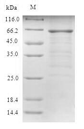 Recombinant Human UV excision repair protein RAD23 homolog A(RAD23A)