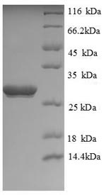 Recombinant Human Ubiquitin carboxyl-terminal hydrolase isozyme L1(UCHL1),partial