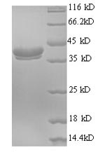 Recombinant Human Ubiquitin-like protein FUBI(FAU)