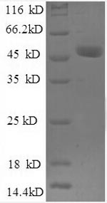 Recombinant Human Ubiquitin thioesterase OTUB1(OTUB1),partial