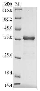 Recombinant Human Uteroglobin(SCGB1A1)