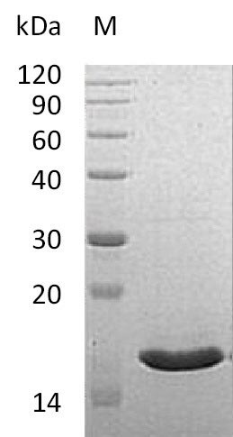 Recombinant Human Vesicle-associated membrane protein-associated protein B/C(VAPB),partial (Active)
