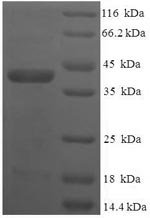 Recombinant Human Vesicle transport through interaction with t-SNAREs homolog 1B(VTI1B) ,partial
