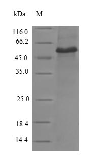 Recombinant Human Vinculin(VCL),partial
