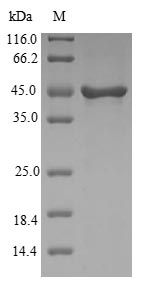 Recombinant Human Visinin-like protein 1(VSNL1)