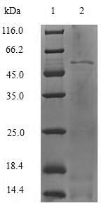 Recombinant Human Vitamin D-binding protein(GC),partial