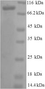 Recombinant Human Vitamin K-dependent protein S(PROS1)