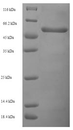 Recombinant Human Voltage-gated potassium channel subunit beta-2(KCNAB2)
