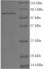 Recombinant Human WD repeat-containing protein 5(WDR5)