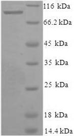 Recombinant Human Xaa-Pro aminopeptidase 1(XPNPEP1)