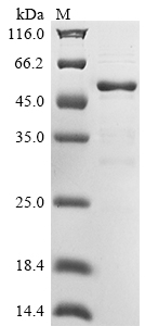 Recombinant Human YjeF N-terminal domain-containing protein 3(YJEFN3)