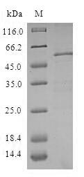 Recombinant Human ZW10 interactor(ZWINT)
